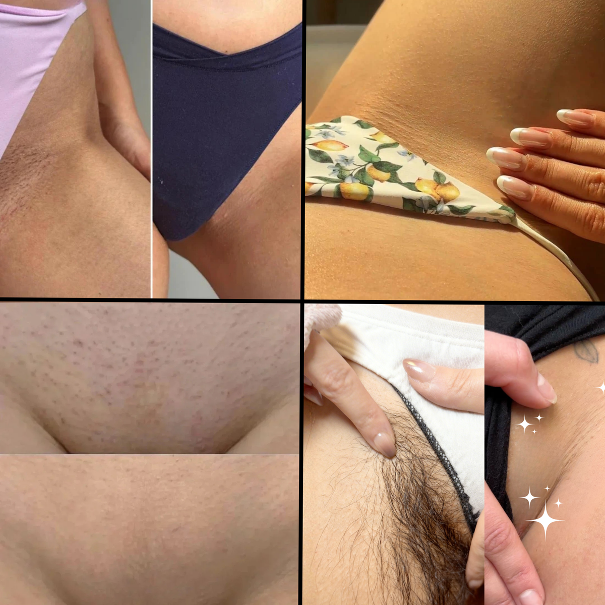 skinbabe – glatte Haut in 2 Minuten